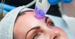 Microneedling RF Treatment in Navi Mumbai