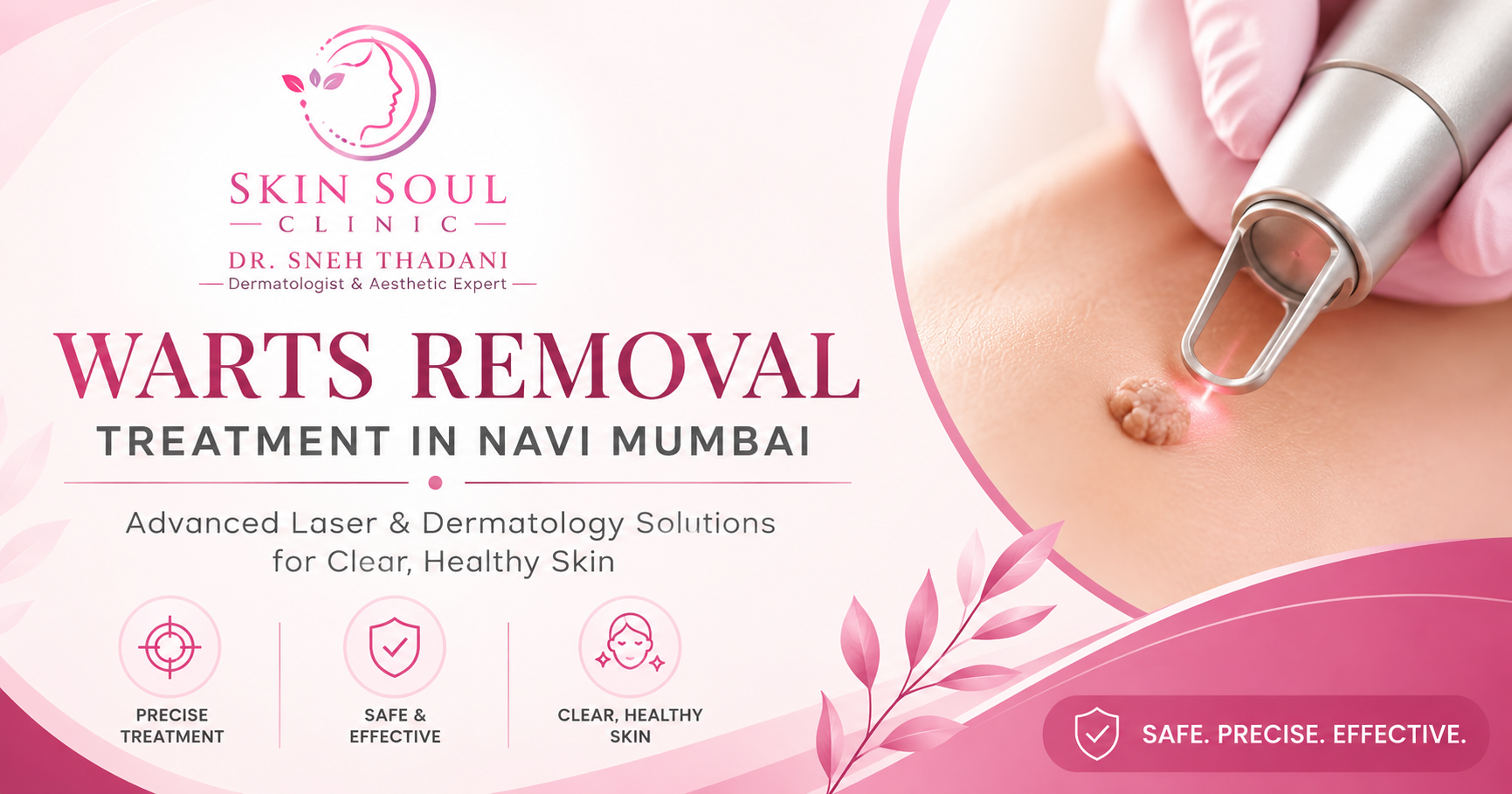 Wart Removal
